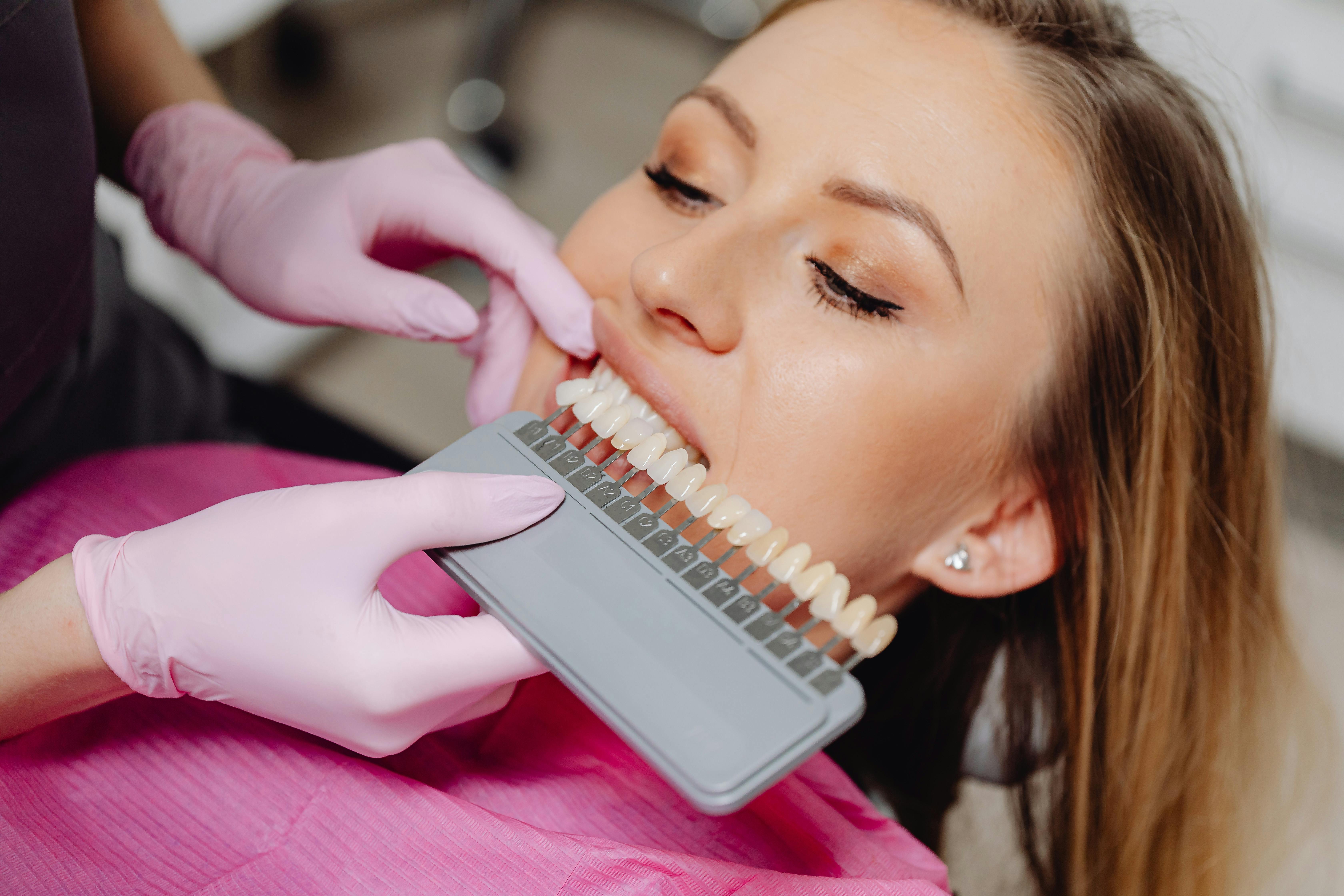Top Cosmetic Dental Procedures in Canada